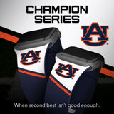 Auburn Tigers HD Apple Watch Band - Wear with style
