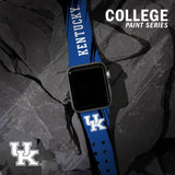 Kentucky Wildcats HD Apple Watch Band - Wear with style