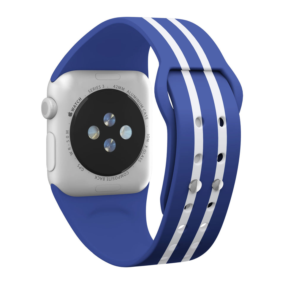 Kentucky Wildcats HD Apple Watch Band - Wear with style