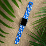 Kentucky Wildcats HD Apple Watch Band - Wear with style