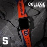 Syracuse Orange HD Apple Watch Band - Wear with style